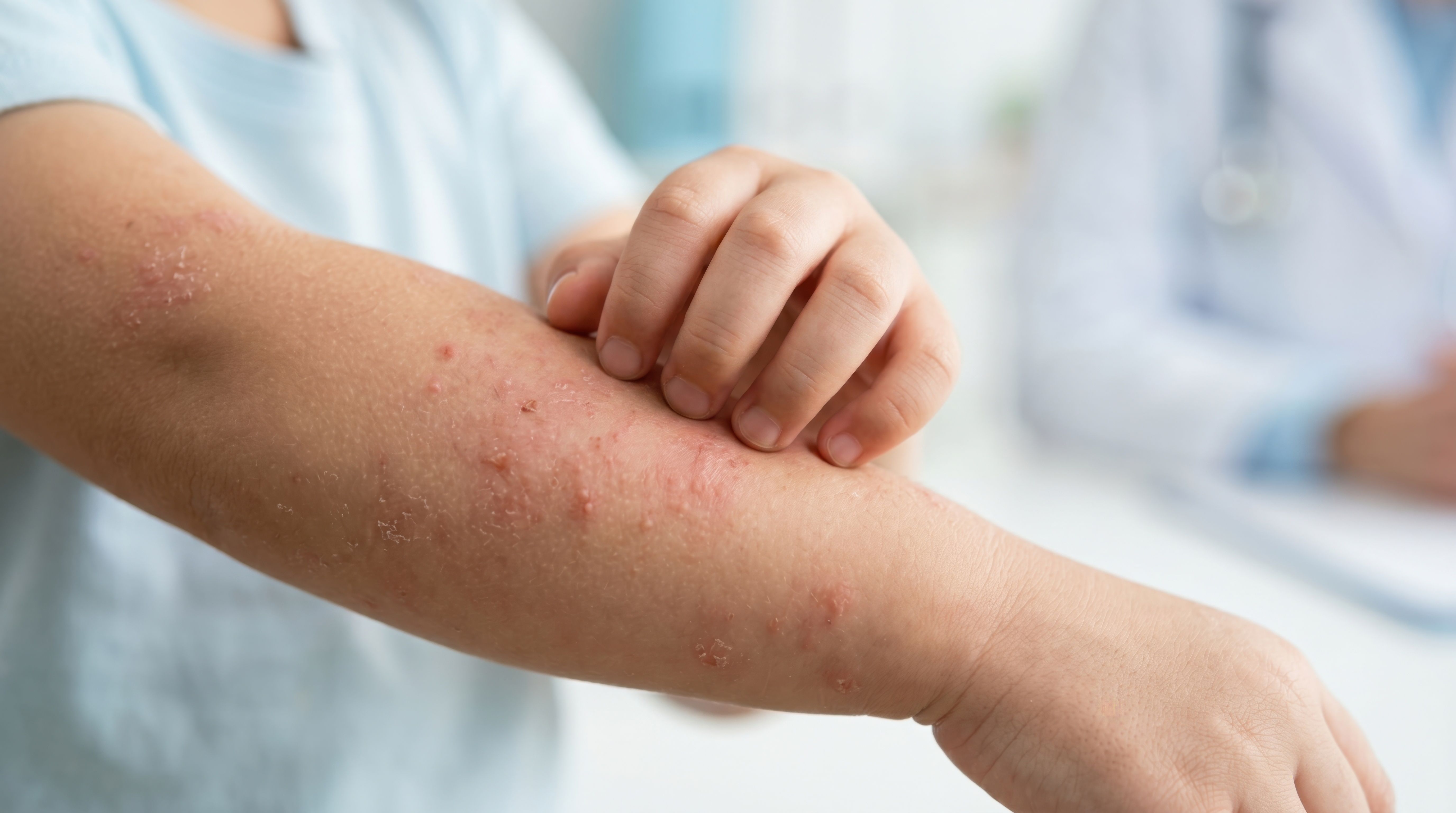 Whole-Patient Care in Pediatric Dermatology: Lessons From SPD 2026 ...