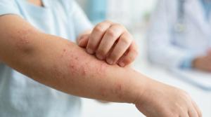 Whole-Patient Care in Pediatric Dermatology: Lessons From SPD 2026
