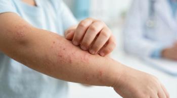 Whole-Patient Care in Pediatric Dermatology: Lessons From SPD 2026