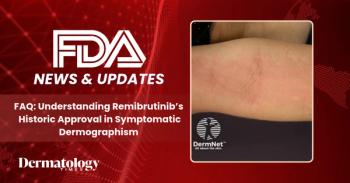 Remibrutinib (Rhapsido) Becomes First FDA-Approved Treatment for Chronic Inducible Urticaria