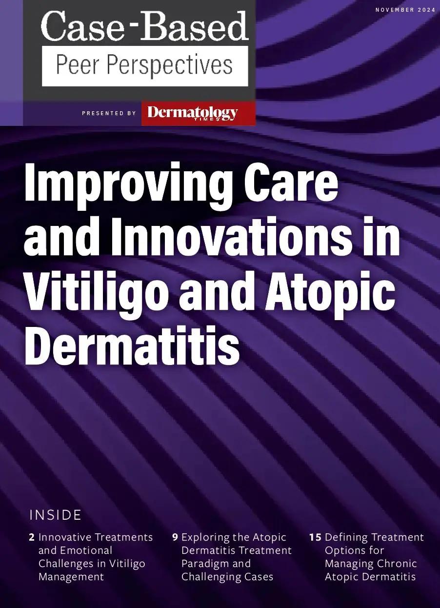 Defining Treatment Options for Managing Chronic Atopic Dermatitis: Part 3