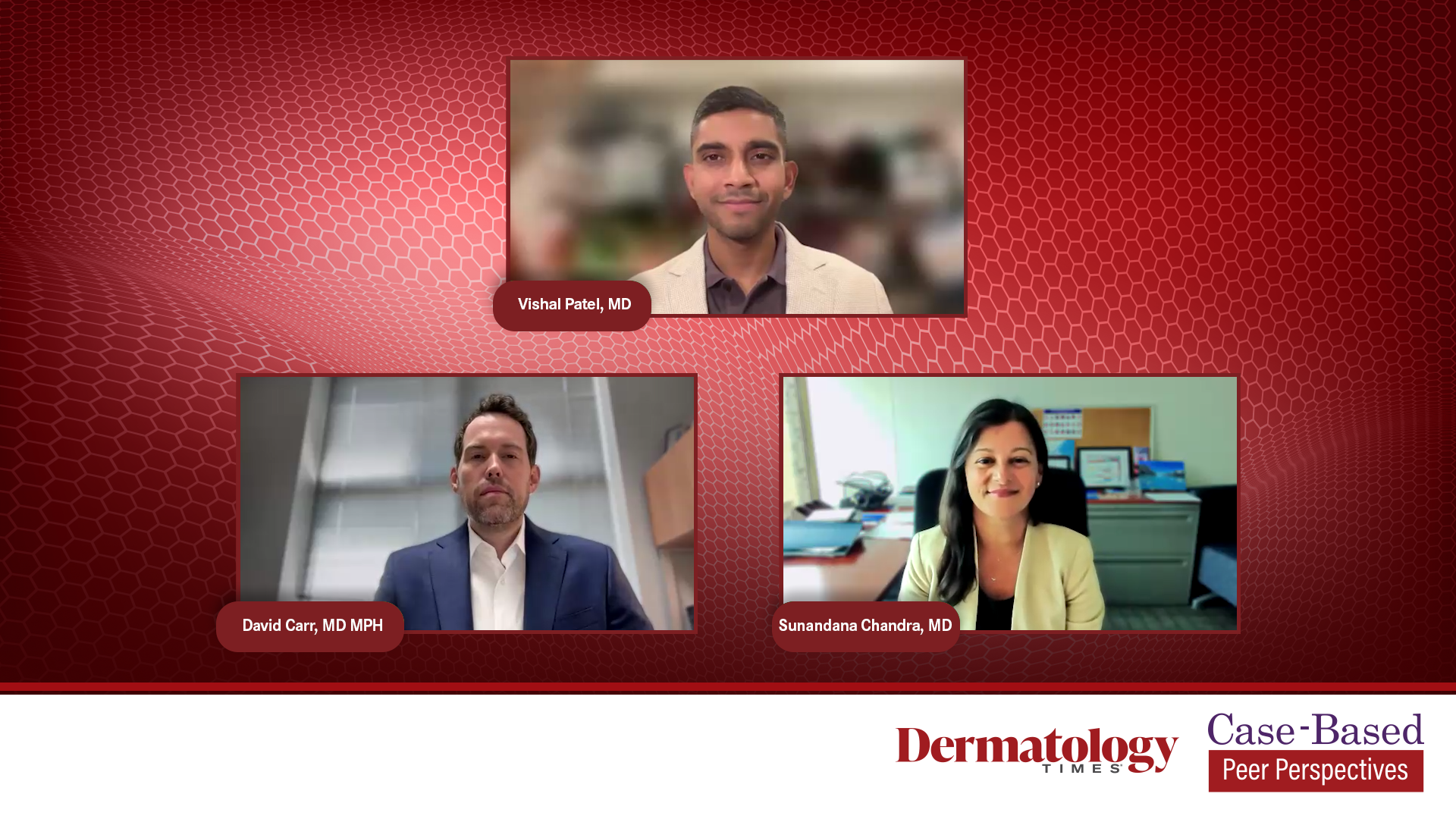Comparing Safety Profiles of Checkpoint Inhibitors in cSCC