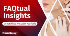 EP. 12 FAQtual Insights: Systemic Risk and Targeted Therapy in GPP