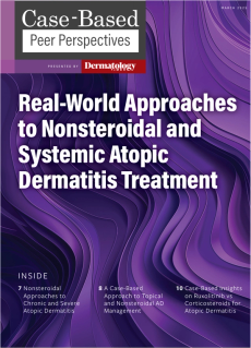 Dermatology Times, Real-World Approaches to Nonsteroidal and Systemic Atopic Dermatitis Treatment, March 2025 (Vol. 46. Supp. 02)