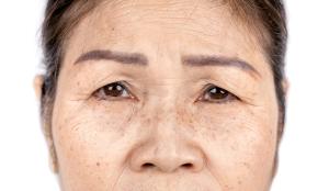 How to Tackle Challenging Cases in Dermatology 