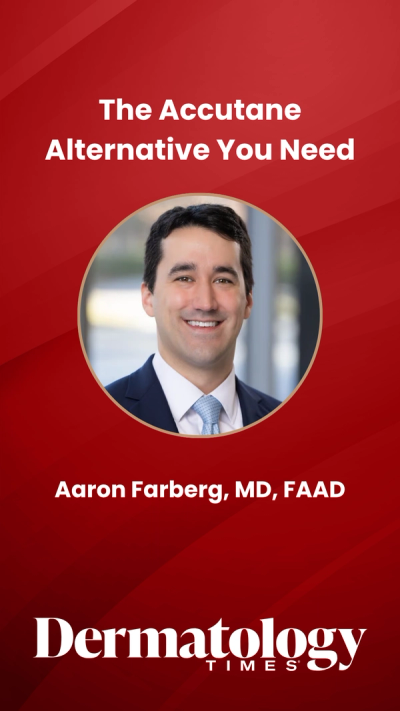 The Accutane Alternative You Need