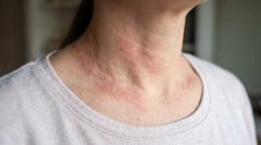 EP. 6 Eczema Awareness Month: Moving Beyond One-Size-Fits-All Care