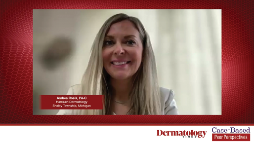 Exploring the Atopic Dermatitis Treatment Paradigm and Challenging Cases