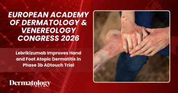 Lebrikizumab Improves Hand and Foot Atopic Dermatitis in Phase 3b ADtouch Trial