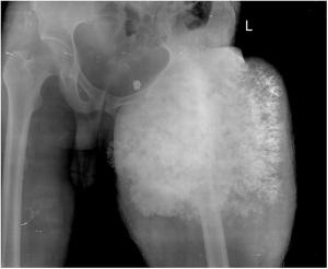 Image IQ: 55-year-old Male, Swelling in Leg