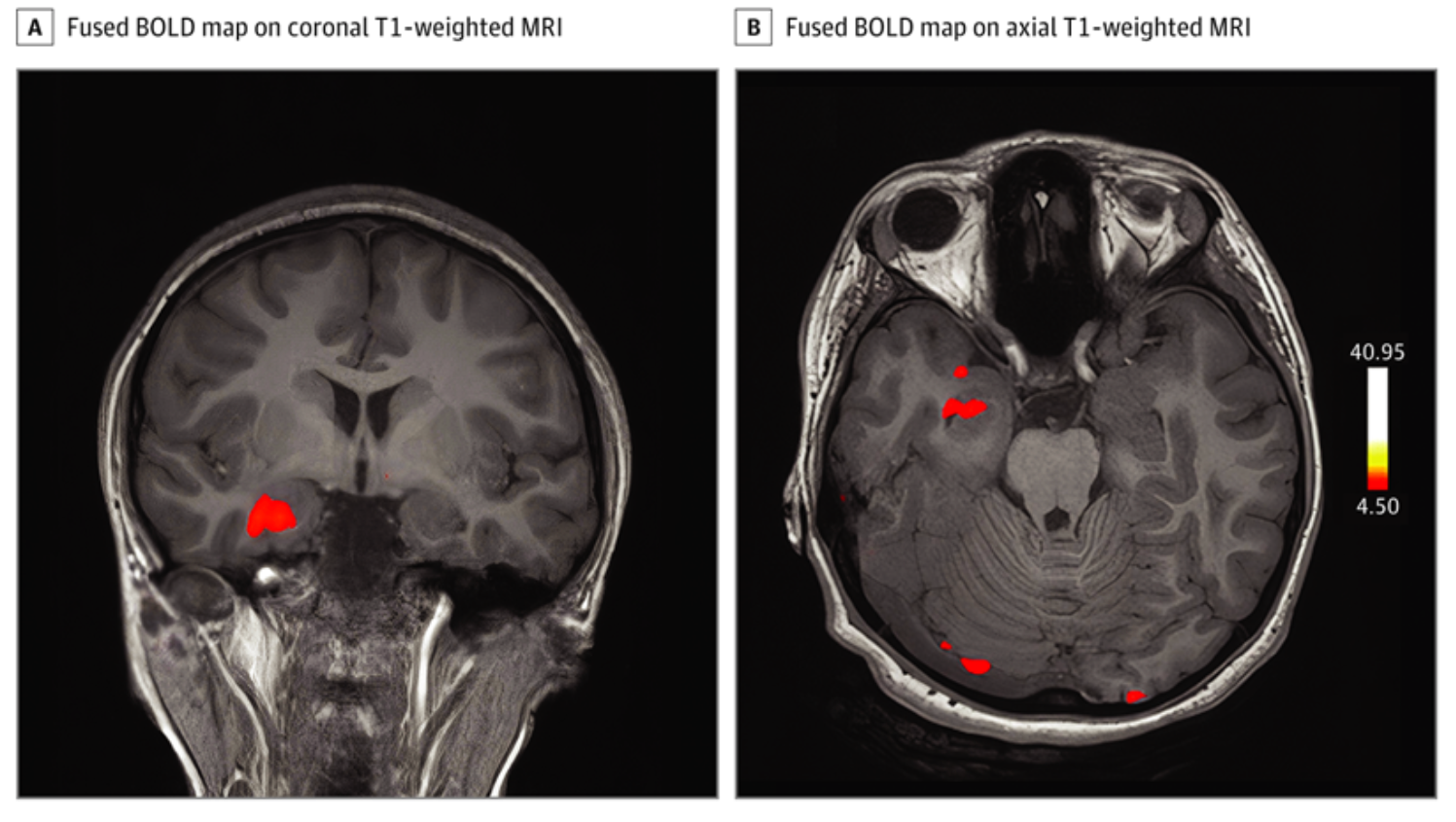 Blood mri t1 weighted The Usefulness