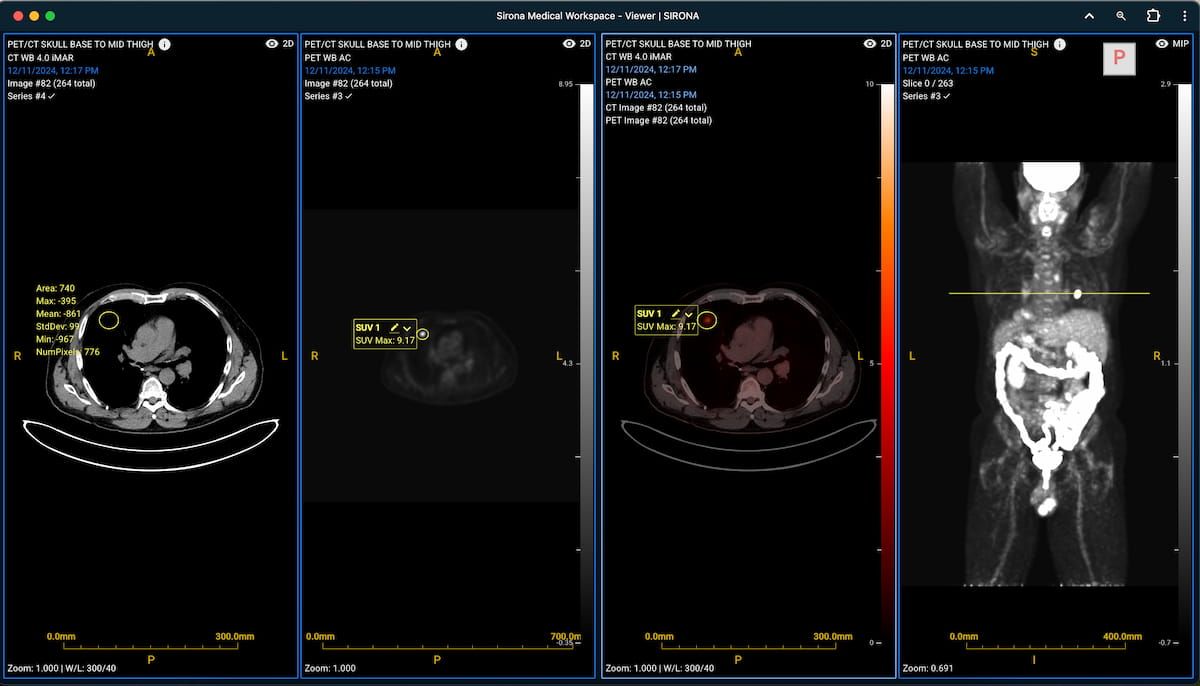 Sirona Medical Gets FDA Nod for Advanced Imaging Suite