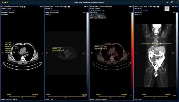 Sirona Medical Gets FDA Nod for Advanced Imaging Suite