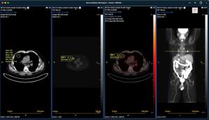 Sirona Medical Gets FDA Nod for Advanced Imaging Suite