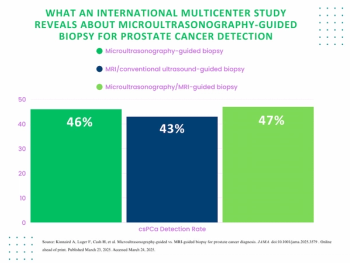 Could Microultrasonography-Guided Biopsy be an Alternative to MRI for PCa Detection in Biopsy-Naïve Men?