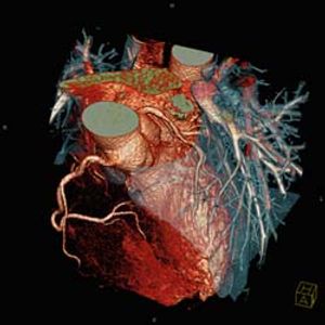 Head for technical exhibition to learn about latest advances in CT