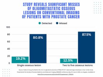SNMMI: Over 80 Percent of Patients with Osseous Oligometastatic PCa are Upstaged with PSMA PET/CT 