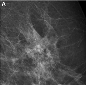 Image courtesy Radiology