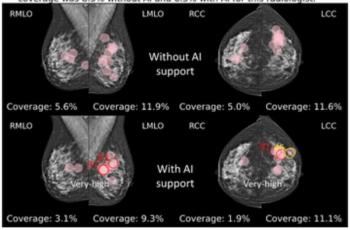 Mammography Study: AI Facilitates Greater Accuracy and Longer Fixation Time on Suspicious Areas