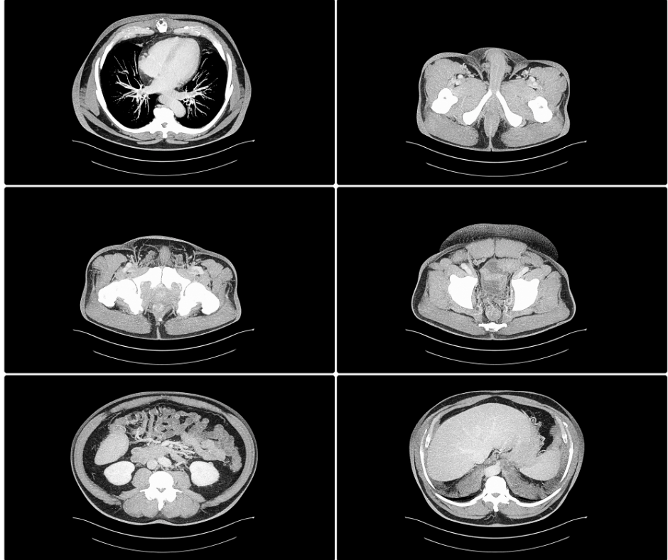 Managing Incidentalomas in Radiology: Embracing Challenges as Opportunities