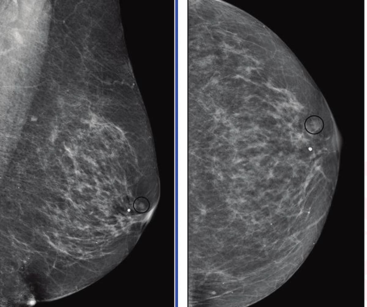 Images courtesy of the American Journal of Roentgenology.