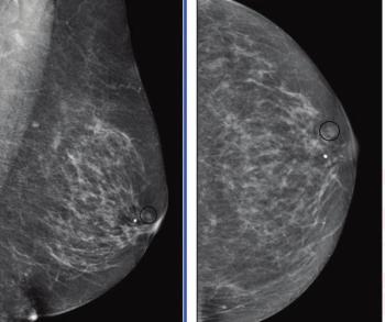 Images courtesy of the American Journal of Roentgenology.