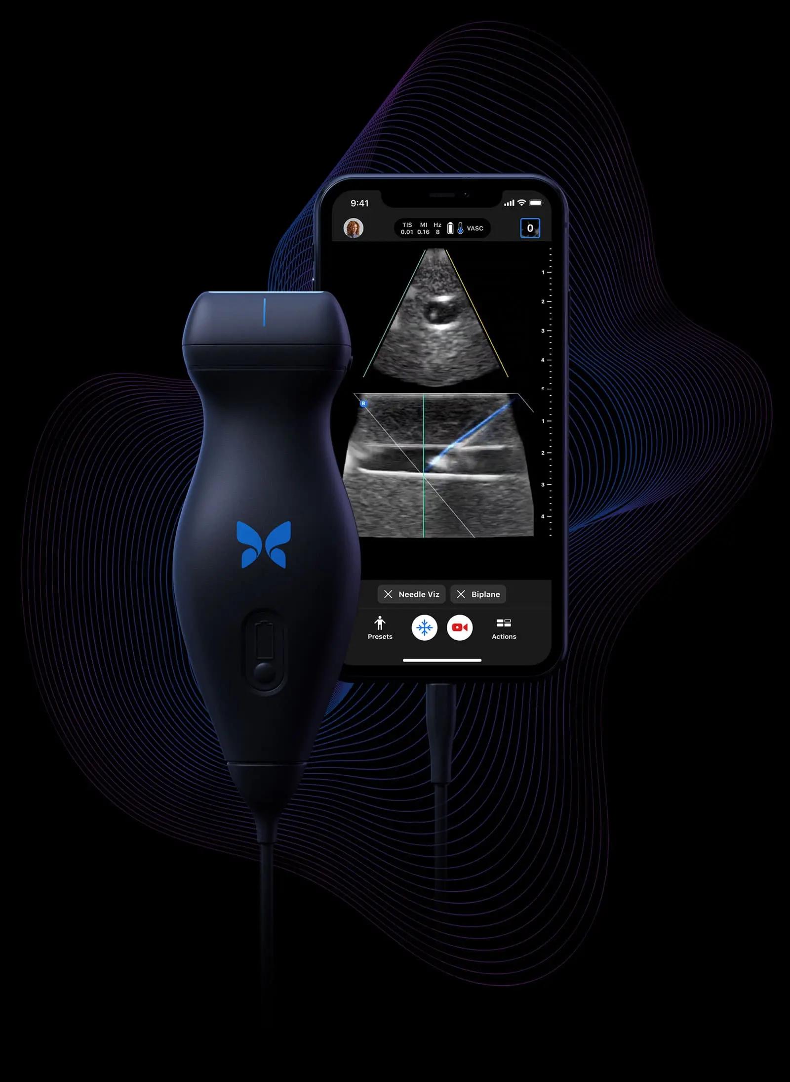 Is Handheld Ultrasound the 'New Stethoscope'?