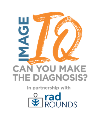 Image IQ Quiz: Patient with Significant Pain and Difficulty Walking After Fall from a Ladder