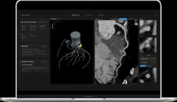 FDA Clears Coronary Plaque Software Module for Coronary CT Angiography