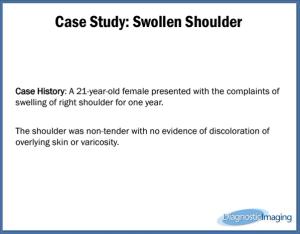 Swollen Shoulder