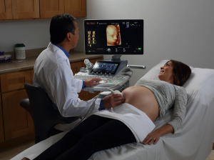 GE ultrasound