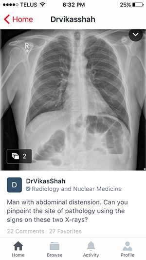 Radiologists Utilize Image-Based Global Networking Tool