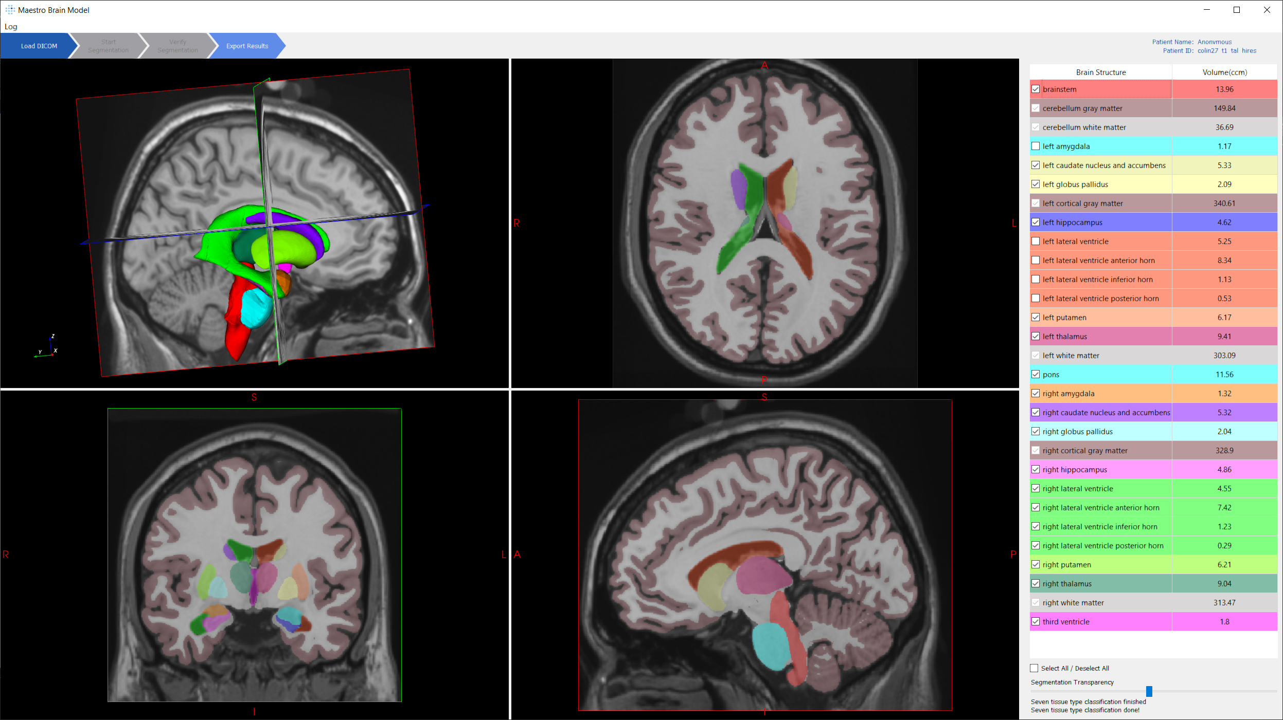 FDA Clears AI-Enabled Software for Streamlining Brain MRI Assessment ...