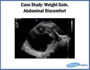 Weight Gain, Abdominal Discomfort