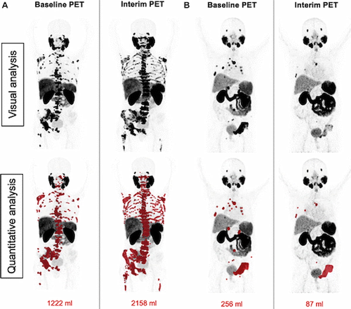 Can an Emerging System Have an Impact in Assessing Treatment Response for Prostate Cancer?