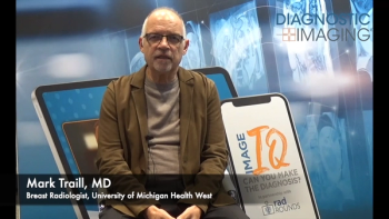 Current and Emerging Insights on AI in Breast Imaging: An Interview with Mark Traill, Part 1