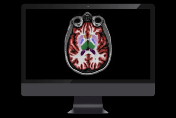 FDA Clears Updated AI Software for MRI Neuroimaging