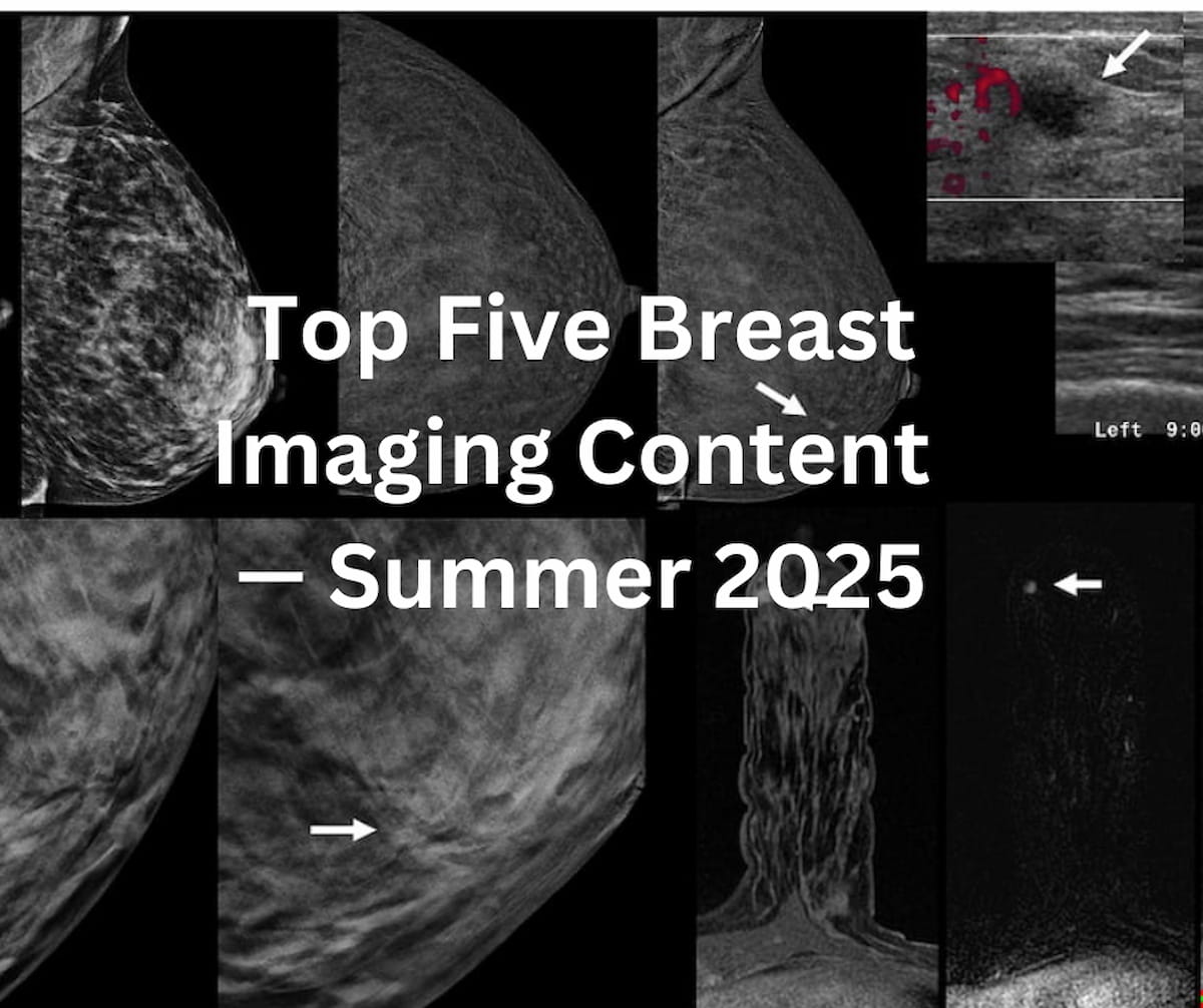 Diagnostic Imaging’s Top Five Breast Imaging Content: Summer 2025 