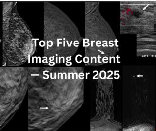 Diagnostic Imaging’s Top Five Breast Imaging Content: Summer 2025