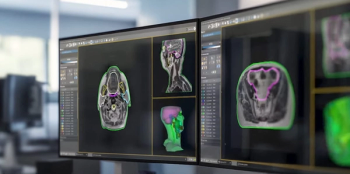 FDA Clears MRI-Based AI Segmentation of Organs at Risk During Radiation Therapy
