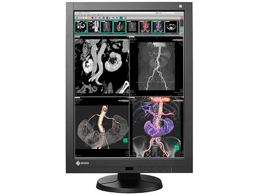6 Innovative High-Performance Displays for Radiology
