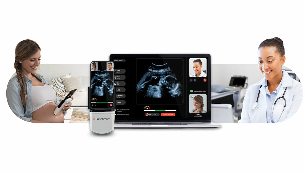 FDA Grants De Novo Approval for Home Use of Prenatal Ultrasound Platform