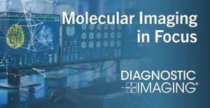 Molecular Imaging in Focus: Emerging Insights on the PET and SPECT Imaging Agent 61Cu-NU101 for PCa