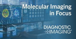 Molecular Imaging in Focus: Incorporating PSMA PET into Risk Stratification for Prostate Cancer