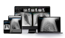 Intelerad Launches New Imaging Software Suite at HIMSS 2022