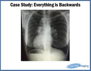 Everything is Backwards