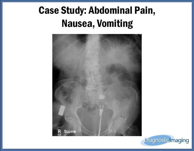 abdominal-pain-nausea-vomiting-diagnostic-imaging