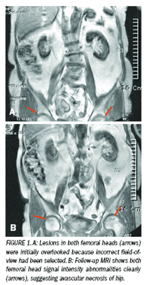 Critical hip disorders show upon spinal imaging studies