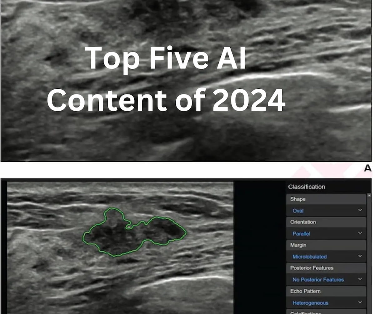 Diagnostic Imaging's Top Five AI Content of 2024