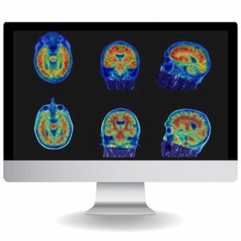 FDA Clears NeuroQuant PET for Assessment of Neurological Conditions